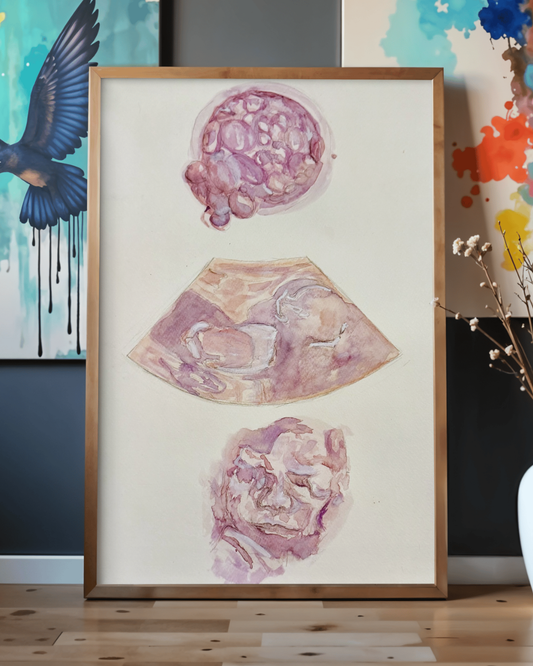 A3 Poster Size Multi Scan Watercolour Painting - Embryo, Ultrasound, 3D Ultrasound