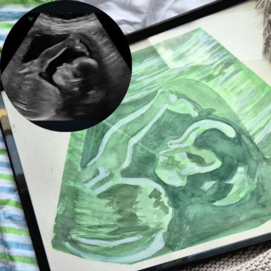 green watercolour ultrasound painting in frame with sonogram scan overlay