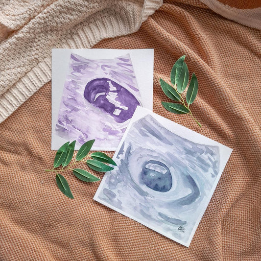 Miscarriage After IVF: Honouring a Loss the World Often Cannot See