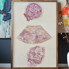 A3 Poster Size Multi Scan Watercolour Painting - Embryo, Ultrasound, 3D Ultrasound
