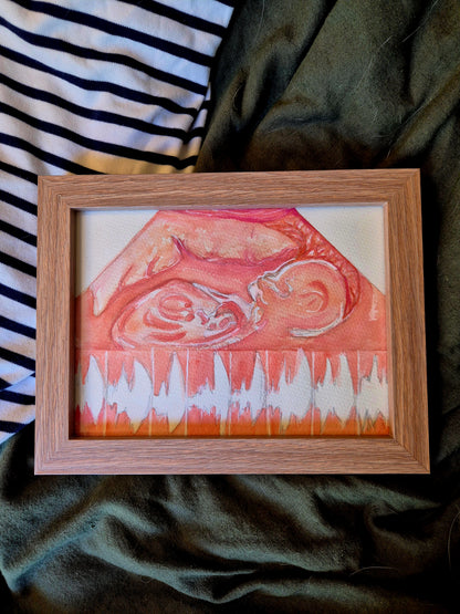 ADD ON Framing