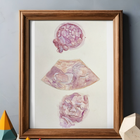 A3 Poster Size Multi Scan Watercolour Painting - Embryo, Ultrasound, 3D Ultrasound