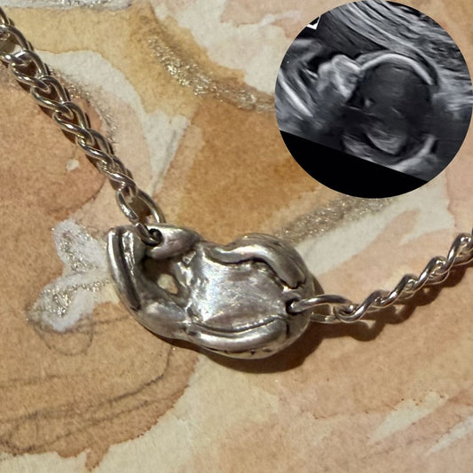 Custom Ultrasound Pendant in 999 Fine Silver