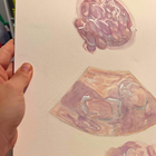A3 Poster Size Multi Scan Watercolour Painting - Embryo, Ultrasound, 3D Ultrasound