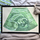 a3 watercolour painting of a 20 week pregnancy ultrasound in a black frame