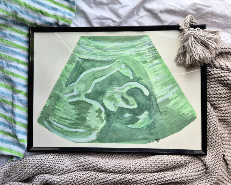 a3 watercolour painting of a 20 week pregnancy ultrasound in a black frame