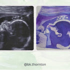 A3 Poster Size Custom Watercolour Ultrasound Painting