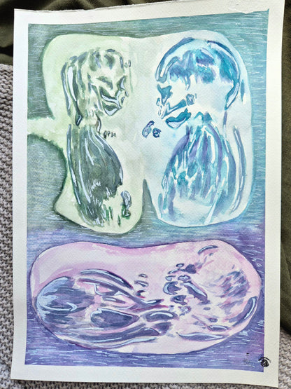 triplet ultrasound painting