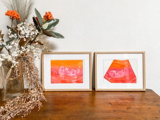 two framed watercolour ultrasound paintings side by side