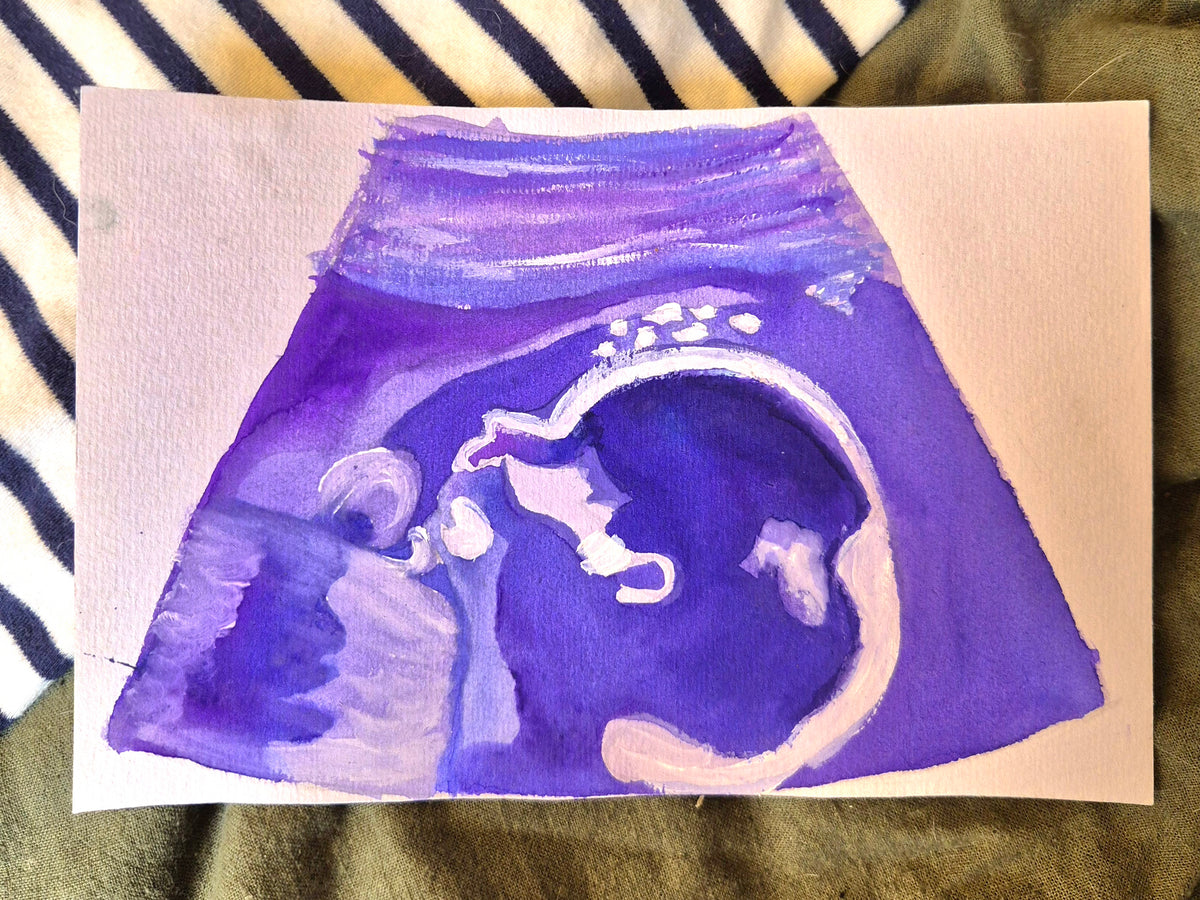 watercolour painting of a 20 week sonogram in purple and white, on a striped background